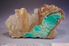 nodule